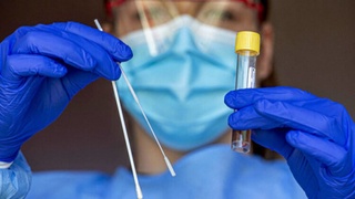 Oʻzbekistonda kecha koronavirusga chalinish boʻyicha 2021-yilning eng yuqori koʻrsatkichi qayd etildi