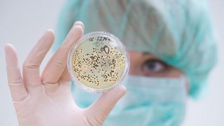 Заболевание "Черная плесень" актуальна только для стран Юго-Восточной Азии