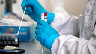 Таҳқиқот: коронавирус ҳуҷайраҳои хуни касони беморшударо тағйир медиҳад