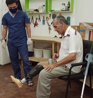 Ўзбекистонда бионик протезлар ишлаб чиқарилмоқда