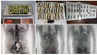 Божхоначилар қарийб 1,7 кг. гиёҳвандлик воситаларини ички аъзоларига яширган шахсларни қўлга олишди
