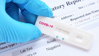 Import without certification of express tests for the detection of antibodies and antigens for COVID-19 is allowed