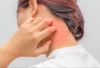 Zardob kasalligidan kimlar aziyat chekadi?