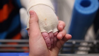 Эффект бабочки: как в Узбекистане помогают детям с редким заболеванием