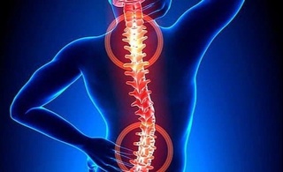 Bel og'rig'i tashxisi taktikasini tanlash dasturiga guvohnoma berildi