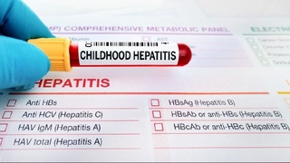 Номаълум жигар инфекциясига чалинган болалар сони 700 нафардан ошди