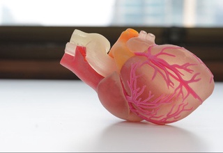 Italiyada dunyoda birinchi marta urib turgan yurak transplantatsiyasi amalga oshirildi