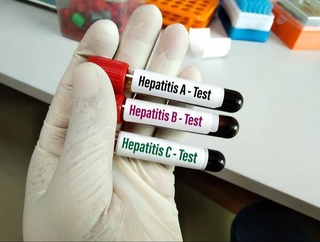 ВОЗ: от гепатита каждые 30 секунд умирает один человек