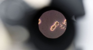 Коронавируснинг янги белгилари аниқланди