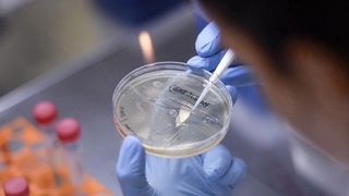 Rossiyada ishlab chiqarilgan vaksinaning narxi qancha?