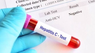 Вирусты гепатитті анықтау  үшін тегін скринингтік тексерулер жүргізілуде — ДСМ
