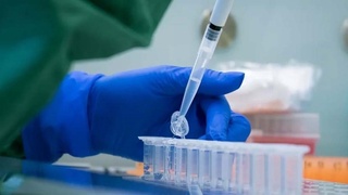 Словакия халқининг ярми бир кунда коронавирусга текширишдан ўтди