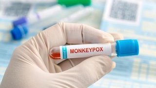 В Китае обнаружен новый штамм вируса оспы обезьян