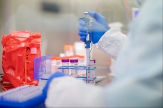 Дунёда коронавирусдан ўлим кўрсаткичлари 17 фоизга камайди