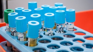 Британских добровольцев заразят Covid-19 для испытания вакцин