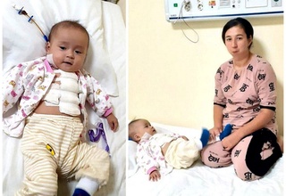 Sardobalik 7 oylik Jasmina tug'ma yurak nuqsonidan xalos bo'ldi