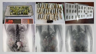 ГНК задержала «глотателей», пытавших провести более 1,5 кг наркотиков в желудках