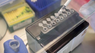 В Узбекистане разработали тест-систему для выявления РНК COVID-2019