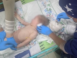 Ҳожатхонага тушиб кетган қизалоқ қутқариб олинди