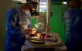 Чимкентда 650 грамм вазнга эга чақалоқнинг кўзини операция қилишди