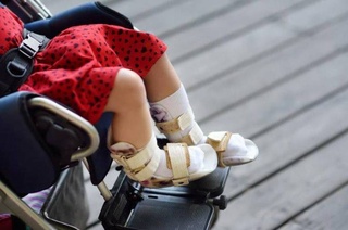 В Узбекистане дети со спинальной мышечной атрофией будут обеспечены необходимым оборудованием для лечения на дому