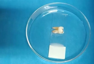 Тишларни паста ва шёткасиз ювиш усули кашф этилди