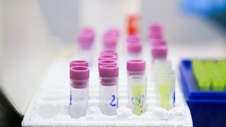 ЖАРда вабо эпидемияси туфайли 22 киши ҳаётдан кўз юмди