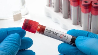 Ученые: антитела у переболевших COVID-19 сохраняются больше года