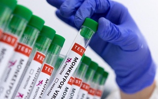 Таиландда mpox вирусининг янги штамми билан касалланишнинг биринчи ҳолати қайд этилди