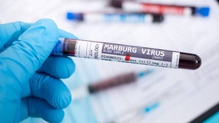 ВОЗ предупредила, что обнаруженный в Африке вирус Марбург, может превзойти COVID-19