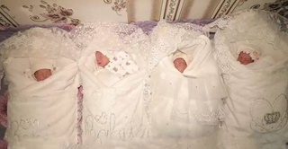 Toshkentda 4 nafar egizak chaqaloq dunyoga keldi