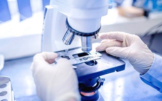 Alsgeymer kasalligiga qarshi dori vositasi ishlab chiqildi