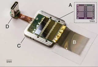 Ilon Mask ikkinchi odamga Neuralink implanti o'rnatilganini e'lon qildi
