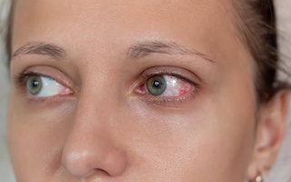 Неожиданный симптом в глазах указывает на «омикрон»