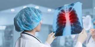 JSST tuberkulyozdan oʻlim koʻrsatkichi oshgani boʻyicha izoh berdi