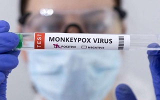 Hindistonda ilk bor maymun chechagining yangi shtammi bilan kasallanish holati aniqlandi