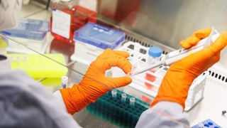 Маймун чечаги аниқланган мамлакатлар сони элликка яқинлашди