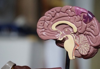 Olimlar miyaga ta'sir o'tkazish orqali semizlikni davolashni taklif qilishdi