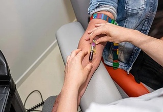 Miya saratonini qon tahlili asosida aniqlash usuli ishlab chiqildi