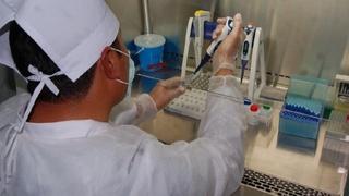 OIVga chalingan bemorlar 22 turdagi virusga qarshi dorilar bilan bepul ta’minlanadi