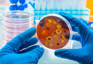 Yaponiyada o'limga olib keladigan infeksiya avj olmoqda