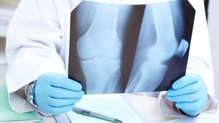 Россиялик ортопед-шифокорлар Ўзбекистонга келади