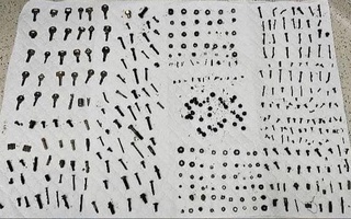 Эронлик шифокорлар эркакнинг ошқозонидан 452 та металл буюмларни олиб ташлашди