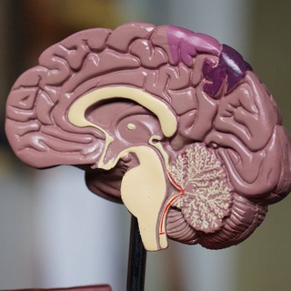 Demensiya kasalligida miya faoliyatini tiklashning yangi usuli ishlab chiqildi