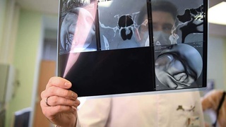 Shifokor nosogʻlom turmush tarzining saraton rivojlanishiga taʼsiri haqida gapirdi