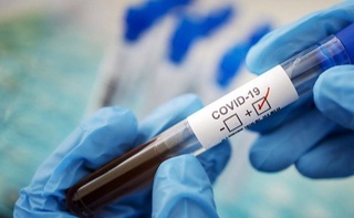 Коронавирус билан касалланганлар сони ортмоқда