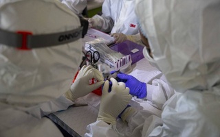 Хитойда кўршапалаклар орасидан иккита хавфли вирус топилди