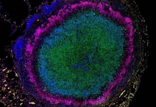 Silga qarshi kurashishning samarali usuli aniqlandi