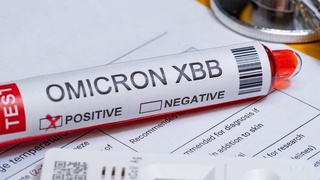 JSST “omikron”ning yangi XBB.1.16 subvariantini kuzatuv ostiga oldi