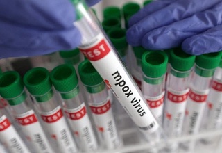 Дар ИМА аввалин ҳолати сироят ба гулӯи маймунҳо сабт гардид